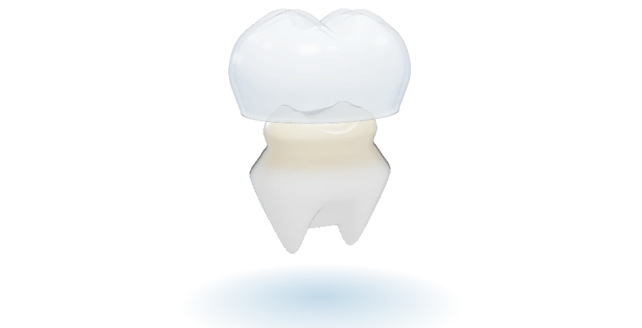 Tooth shaped into a core with a crown lowering over it