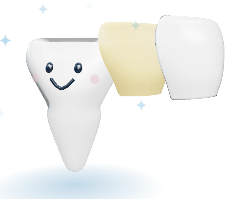 A front tooth with a thin enamel layer lifted off and a porcelain shell beside it